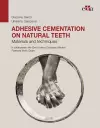 Adhesive cementation on natural teeth - Materials and techniques cover