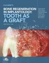 Bone regeneration in implantology - tooth as a graft cover