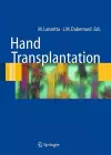 Hand transplantation cover