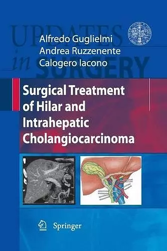 Surgical Treatment of Hilar and Intrahepatic Cholangiocarcinoma cover