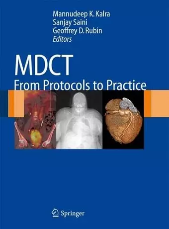 MDCT cover