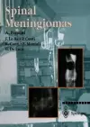 Spinal Meningiomas cover