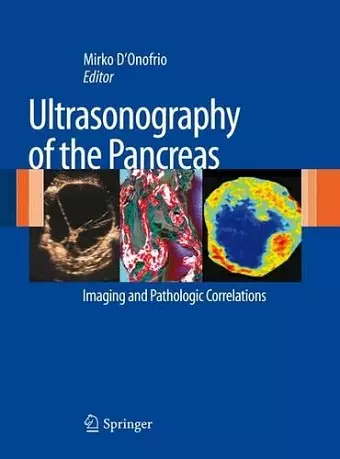 Ultrasonography of the Pancreas cover