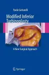 Modified Inferior Turbinoplasty cover