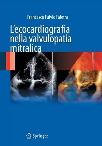 L'ecocardiografia nella valvulopatia mitralica cover