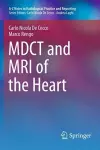 MDCT and MRI of the Heart cover