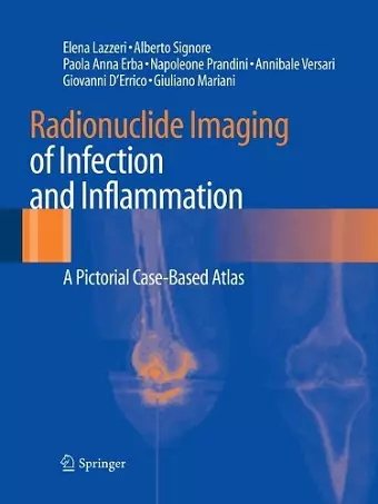 Radionuclide Imaging of Infection and Inflammation cover