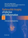 Radionuclide Imaging of Infection and Inflammation cover