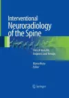 Interventional Neuroradiology of the Spine cover