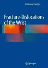 Fracture-Dislocations of the Wrist cover