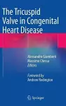 The Tricuspid Valve in Congenital Heart Disease cover