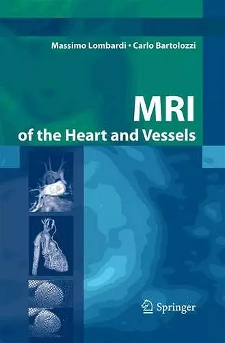 MRI of the Heart and Vessels cover