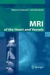 MRI of the Heart and Vessels cover