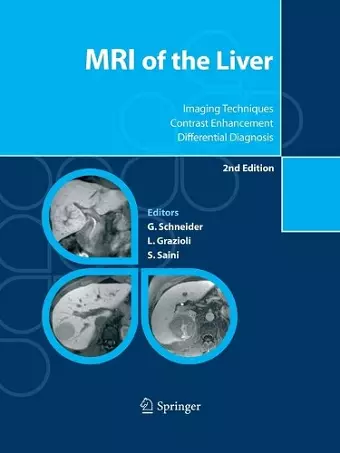 MRI of the Liver cover