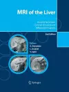 MRI of the Liver cover