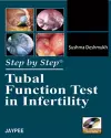 Step by Step Tubal Function Test cover