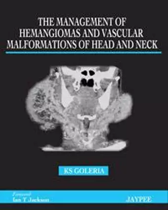 The Management of Haemangiomas and Vascular Malformations of Head and Neck cover