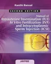 Manual of Intrauterine Insemination (IUI), In Vitro Fertilization (IVF) and Intracytoplasmic Sperm Injection (ICSI) cover