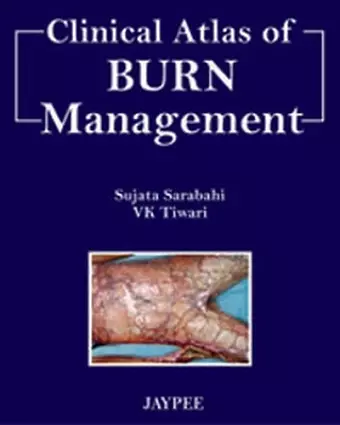 Clinical Atlas of Burn Managment cover