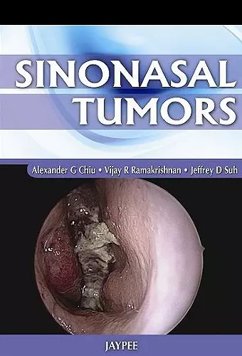 Sinonasal Tumors cover