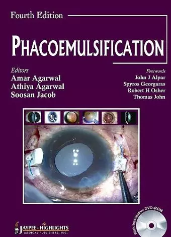 Phacoemulsification, Fourth Edition cover