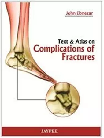 Text and Atlas of Complications of Fractures cover