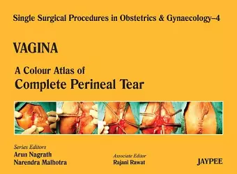 Single Surgical Procedures in Obstetrics and Gynaecology - Volume 4 - VAGINA cover