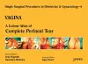 Single Surgical Procedures in Obstetrics and Gynaecology - Volume 4 - VAGINA cover