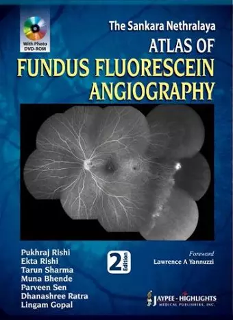 Atlas of Fundus Fluorescein Angiography cover