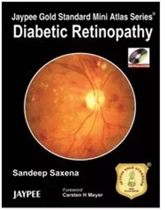 Jaypee Gold Standard Mini Atlas Series: Diabetic Retinopathy cover