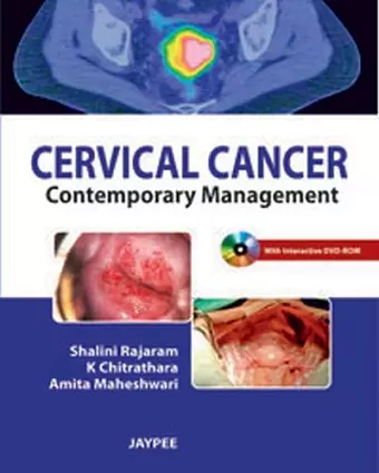 Cervical Cancer cover