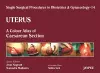 Single Surgical Procedures in Obstetrics and Gynaecology - Volume 14 - Uterus cover