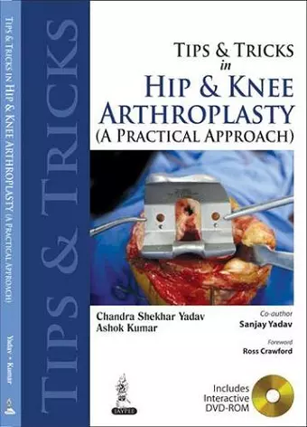 Tips and Tricks in Hip and Knee Arthroplasty cover