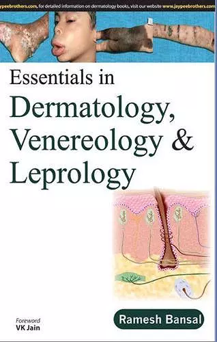 Essentials in Dermatology, Venereology & Leprology cover