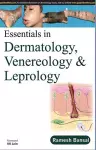 Essentials in Dermatology, Venereology & Leprology cover