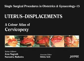 Single Surgical Procedures in Obstetrics and Gynaecology - Volume 15 - UTERUS - DISPLACEMENTS cover