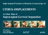 Single Surgical Procedures in Obstetrics and Gynaecology - Volume 16 - UTERUS - DISPLACEMENTS cover