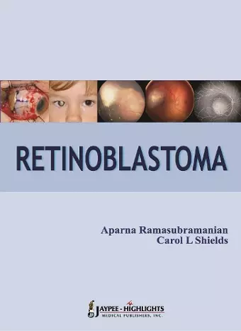 Retinoblastoma cover