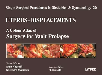 Single Surgical Procedures in Obstetrics and Gynaecology - Volume 20 - UTERUS - DISPLACEMENTS cover