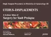 Single Surgical Procedures in Obstetrics and Gynaecology - Volume 20 - UTERUS - DISPLACEMENTS cover