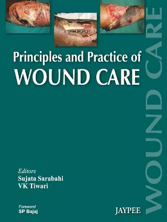 Principles and Practice Of Wound Care cover