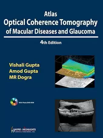 Atlas Optical Coherence Tomography of Macular Diseases and Glaucoma cover