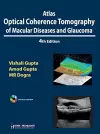 Atlas Optical Coherence Tomography of Macular Diseases and Glaucoma cover