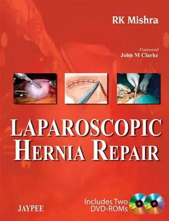 Laparoscopic Hernia Repair cover