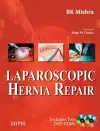 Laparoscopic Hernia Repair cover