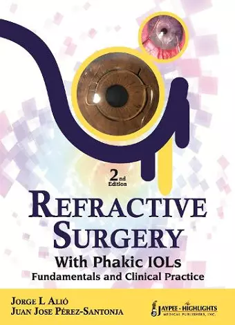 Refractive Surgery with  Phakic  IOLs cover