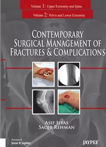 Contemporary Surgical Management of Fractures and Complications cover