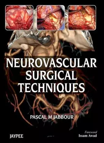 Neurovascular Surgical Techniques cover