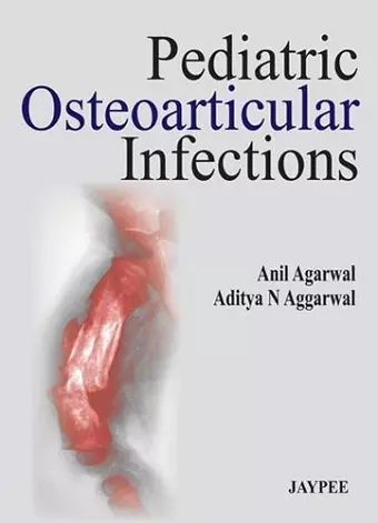 Pediatric Osteoarticular Infections cover