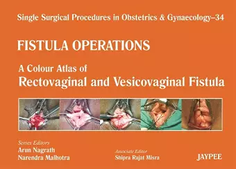 Single Surgical Procedures in Obstetrics and Gynaecology - 34 - Fistula Operations: A Colour Atlas of Rectovaginal and Vesicovaginal Fistula cover